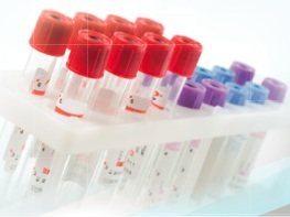 Blood Test Tubes